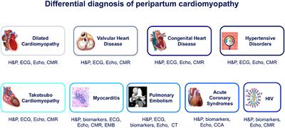 The Role of Multimodality Cardiovascular Imaging in Peripartum Cardiomyopathy